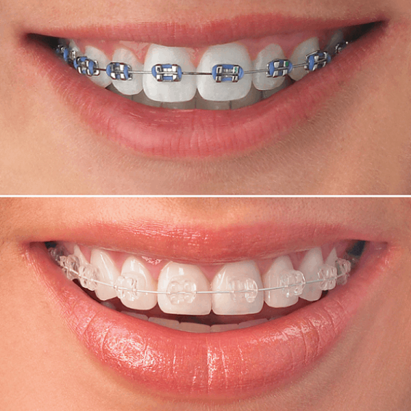 Orthodontics